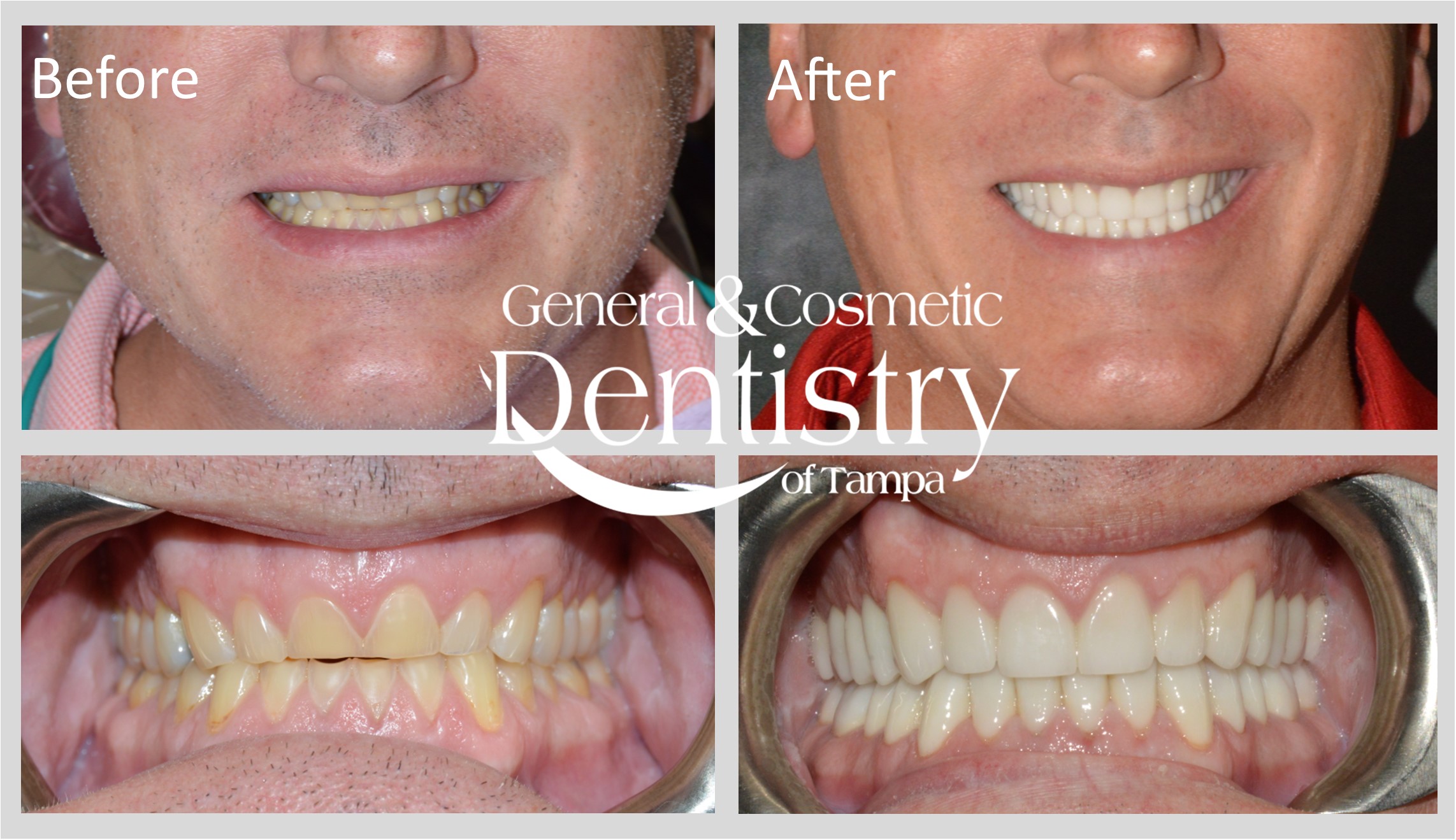 General and Cosmetic Dentistry of Tampa - Randall Diez and Michael Diez