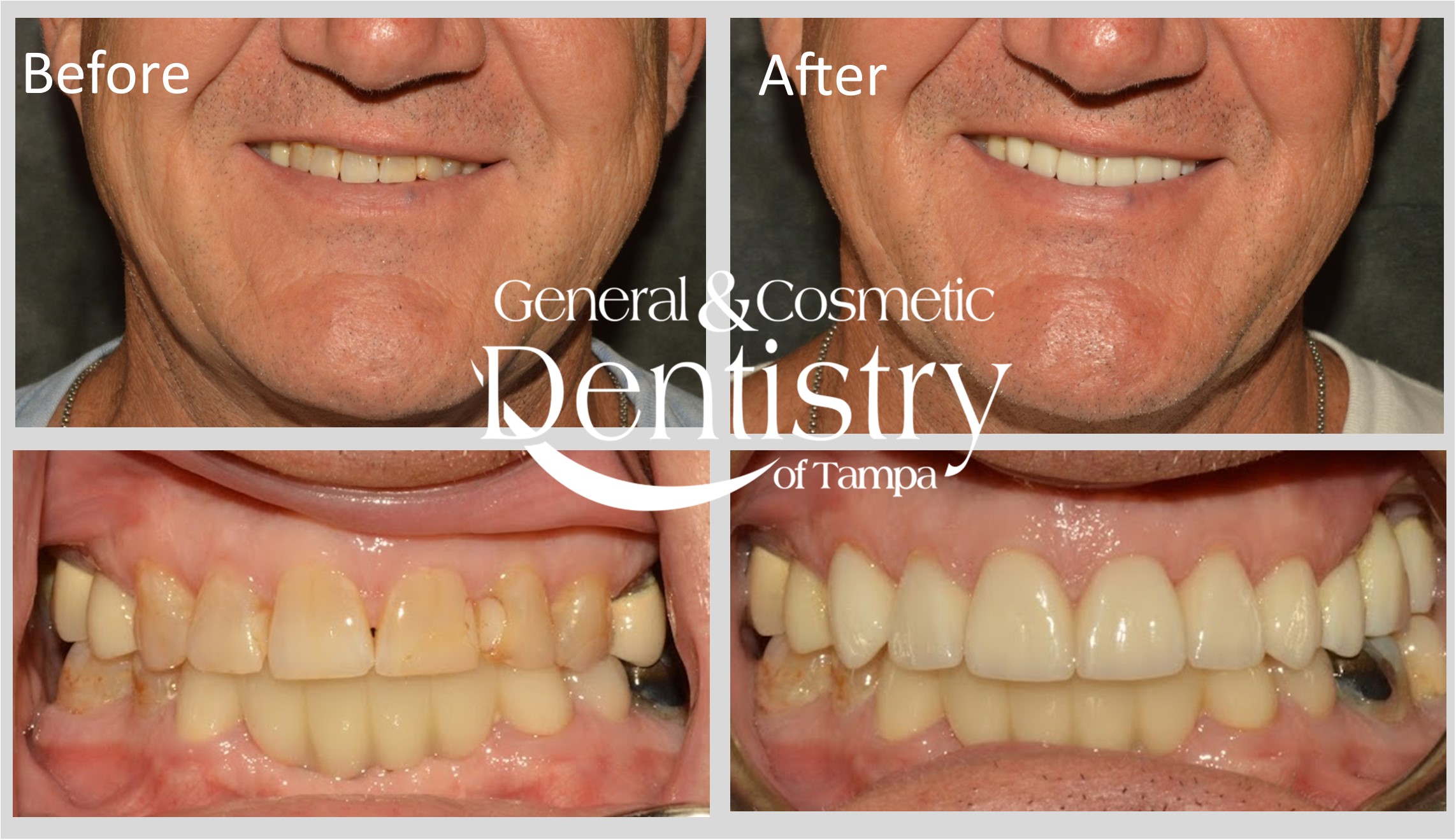 General and Cosmetic Dentistry of Tampa - Randall Diez and Michael Diez