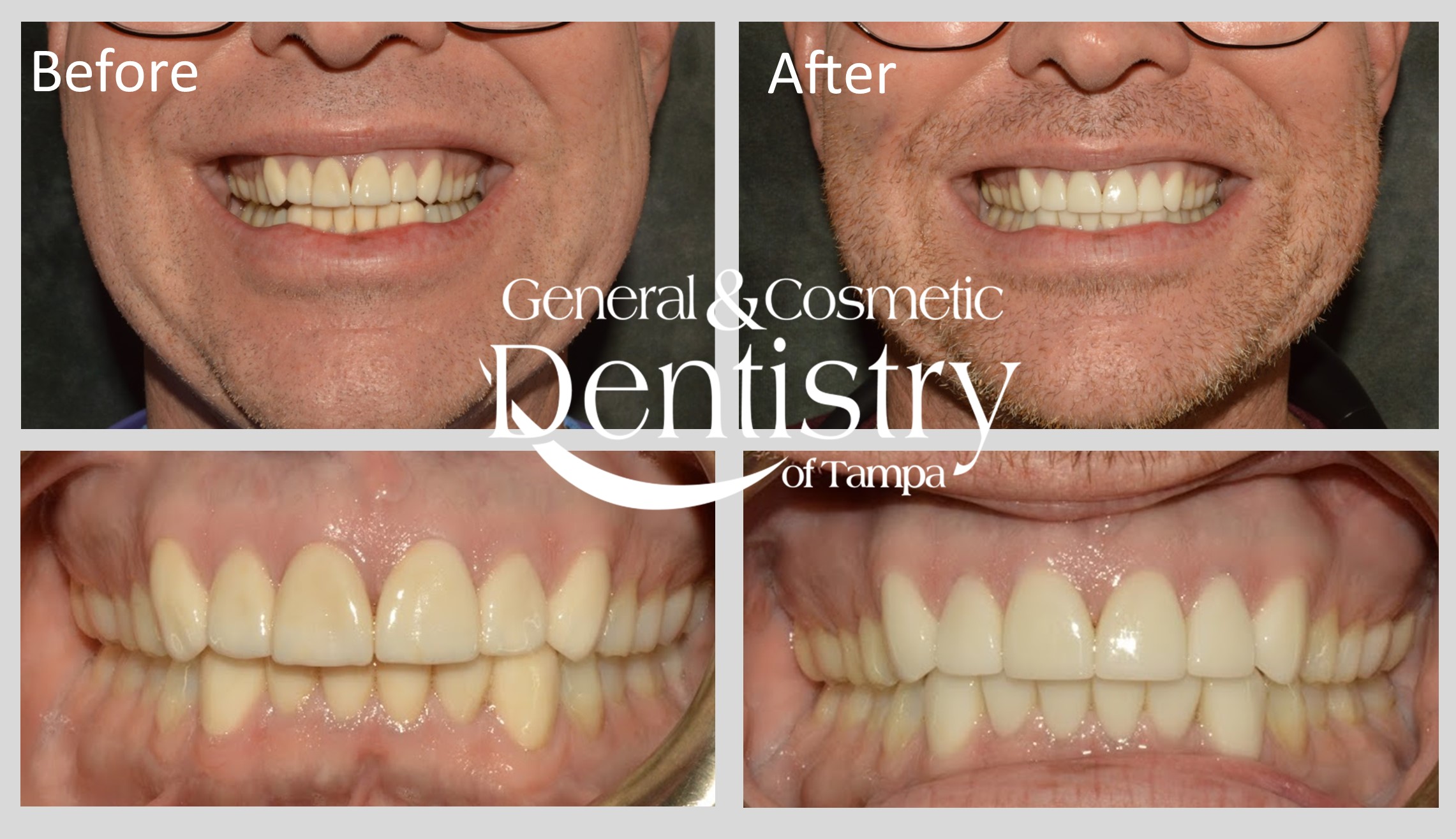 General and Cosmetic Dentistry of Tampa - Randall Diez and Michael Diez