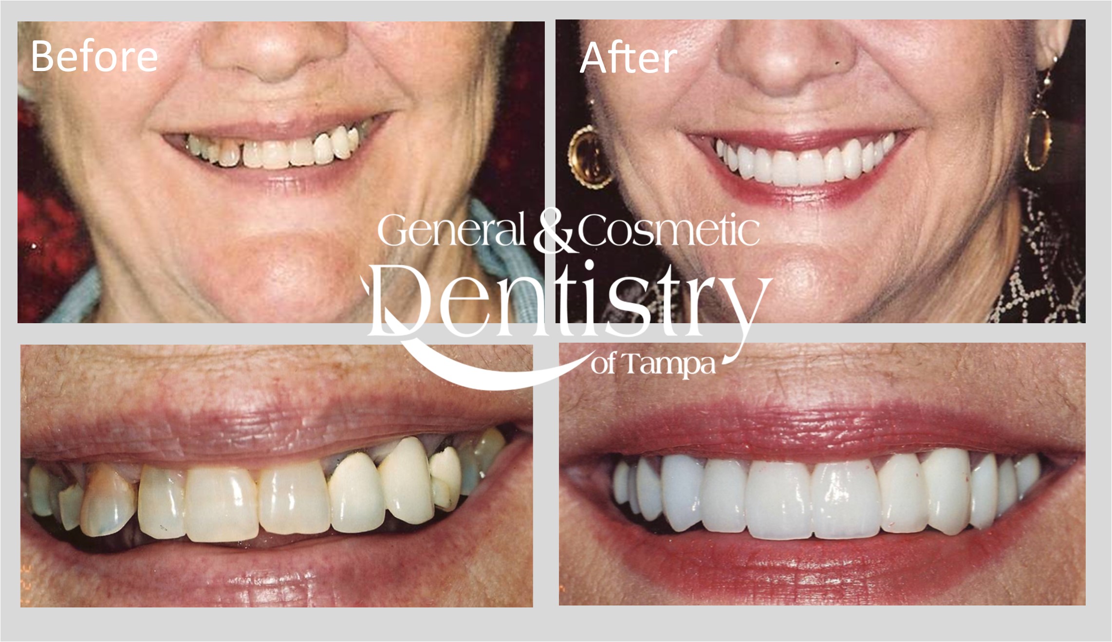 General and Cosmetic Dentistry of Tampa - Randall Diez and Michael Diez