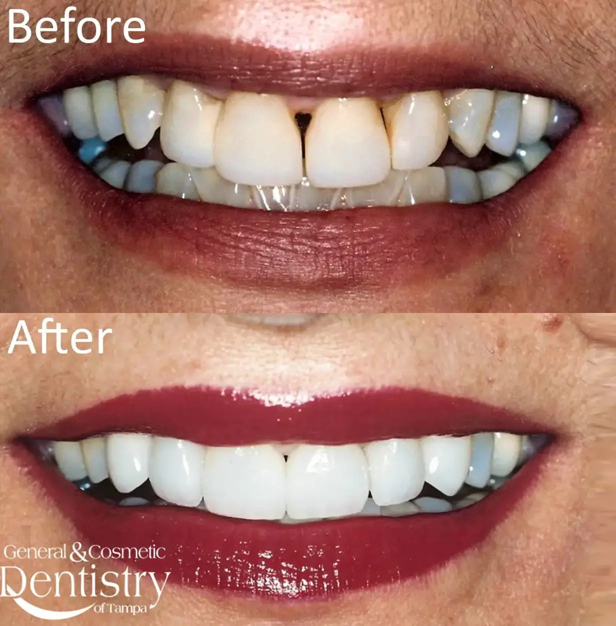 General and Cosmetic Dentistry of Tampa - Randall Diez and Michael Diez