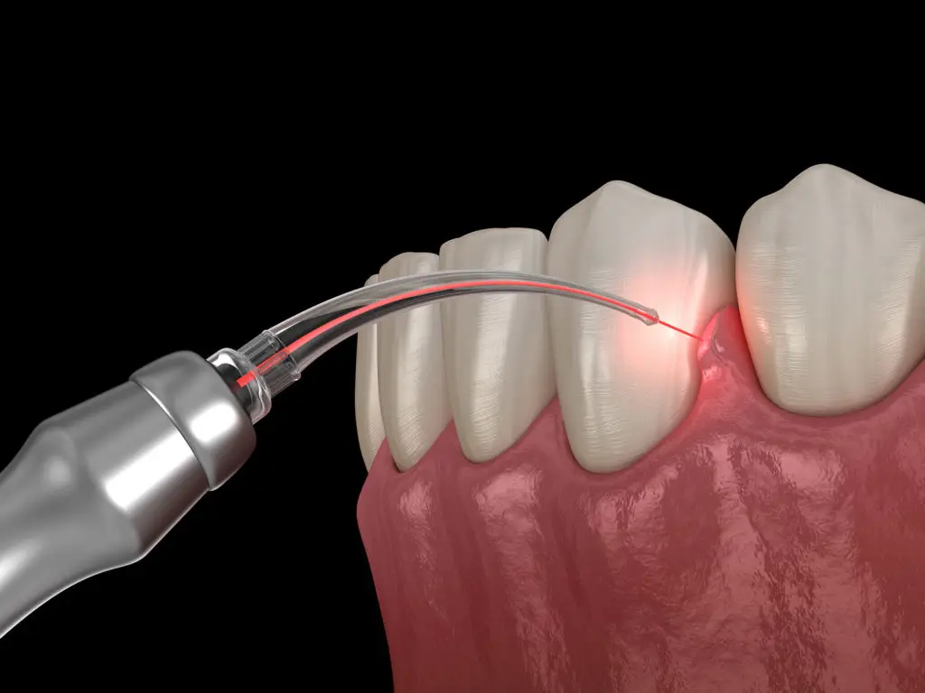 General and Cosmetic Dentistry of Tampa - Randall Diez and Michael Diez General and Cosmetic Dentistry of Tampa - Randall Diez and Michael Diez