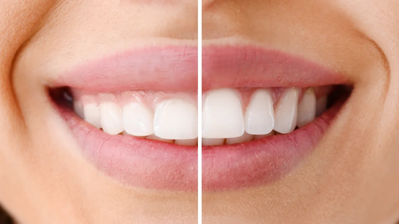 General and Cosmetic Dentistry of Tampa - Randall Diez and Michael Diez General and Cosmetic Dentistry of Tampa - Randall Diez and Michael Diez