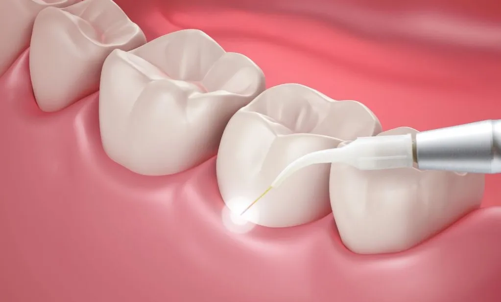 General and Cosmetic Dentistry of Tampa - Randall Diez and Michael Diez