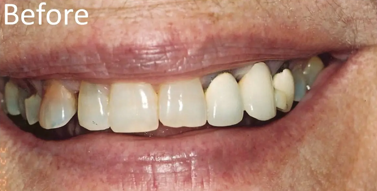 General and Cosmetic Dentistry of Tampa - Randall Diez and Michael Diez