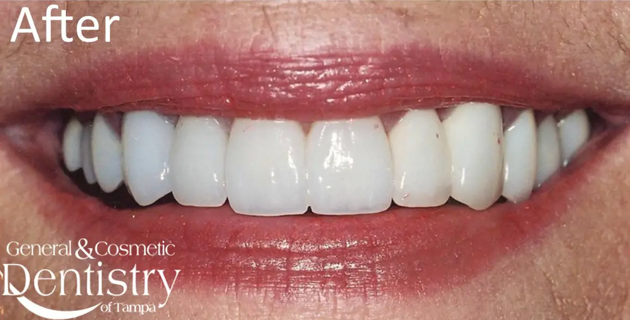 General and Cosmetic Dentistry of Tampa - Randall Diez and Michael Diez