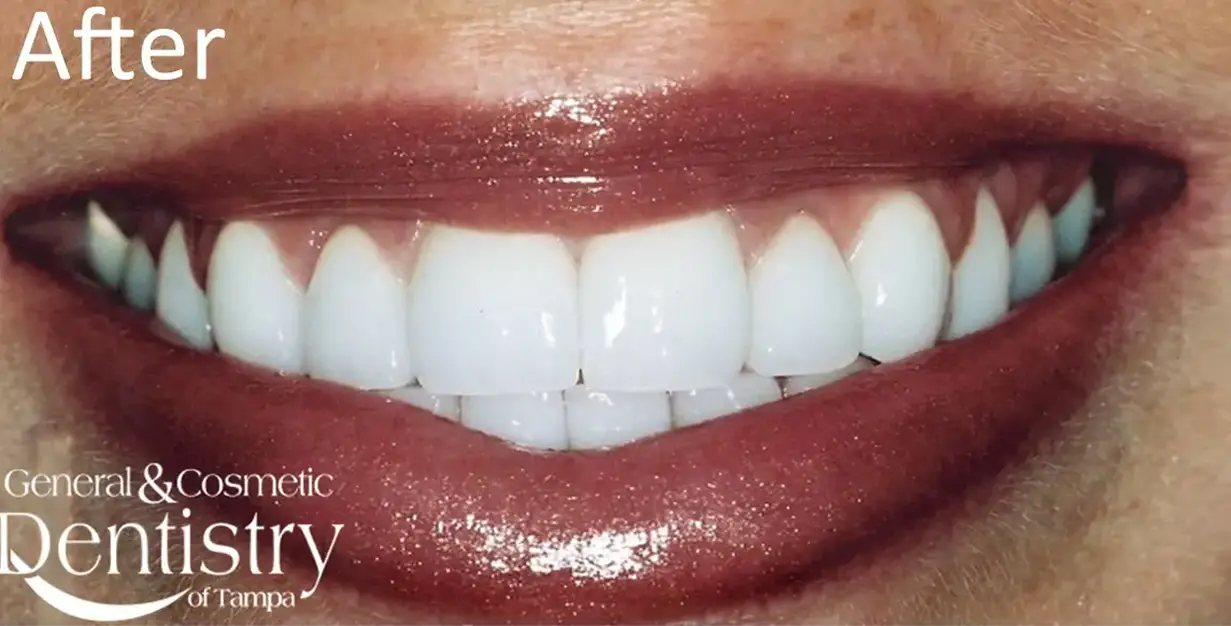 General and Cosmetic Dentistry of Tampa - Randall Diez and Michael Diez