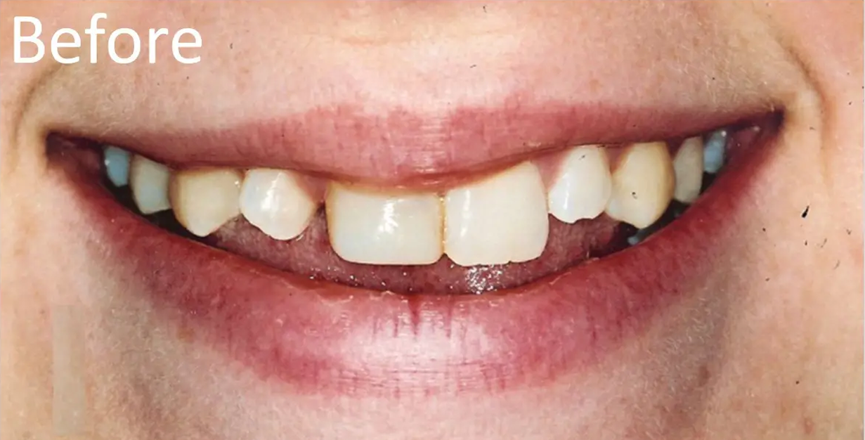 General and Cosmetic Dentistry of Tampa - Randall Diez and Michael Diez