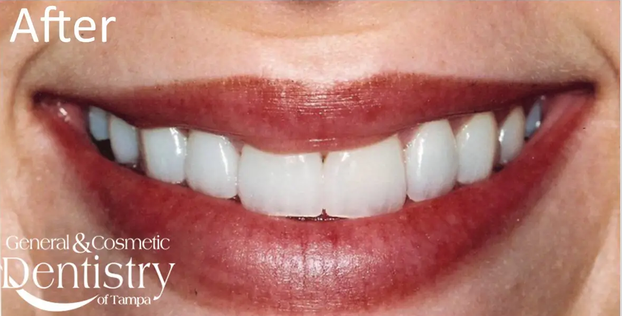 General and Cosmetic Dentistry of Tampa - Randall Diez and Michael Diez