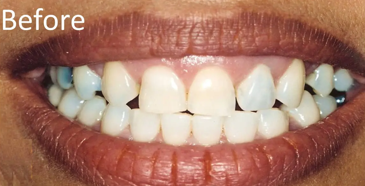 General and Cosmetic Dentistry of Tampa - Randall Diez and Michael Diez