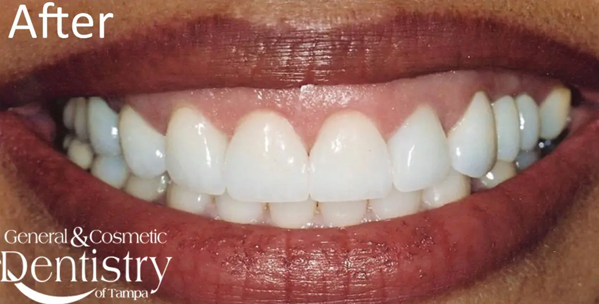 General and Cosmetic Dentistry of Tampa - Randall Diez and Michael Diez