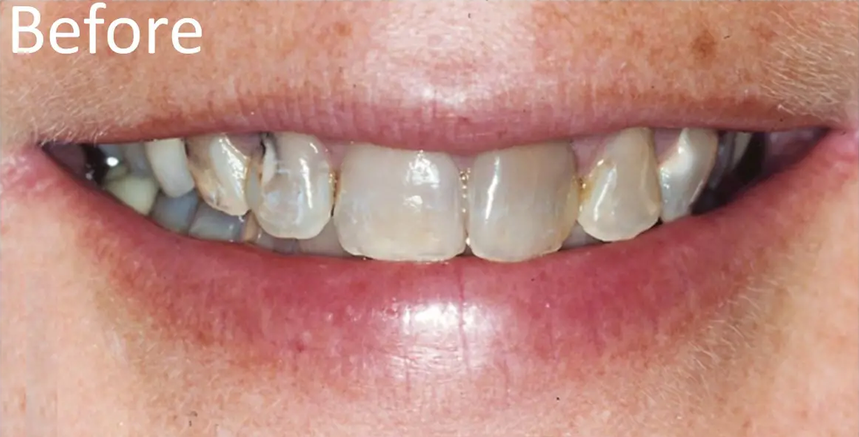 General and Cosmetic Dentistry of Tampa - Randall Diez and Michael Diez