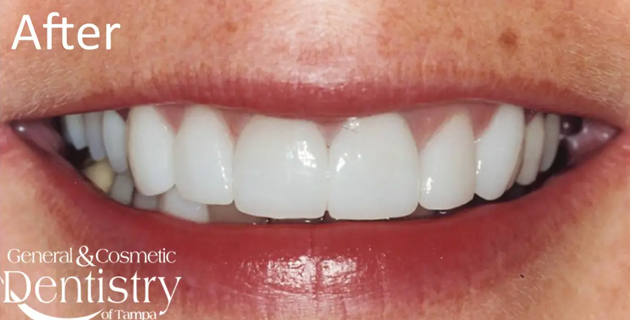 General and Cosmetic Dentistry of Tampa - Randall Diez and Michael Diez