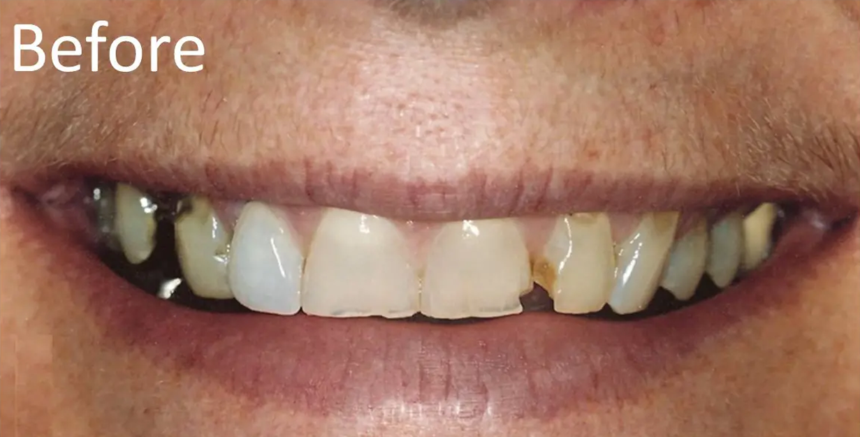 General and Cosmetic Dentistry of Tampa - Randall Diez and Michael Diez