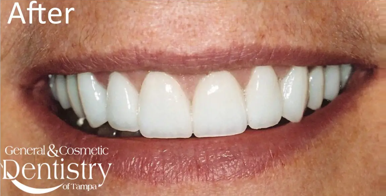 General and Cosmetic Dentistry of Tampa - Randall Diez and Michael Diez