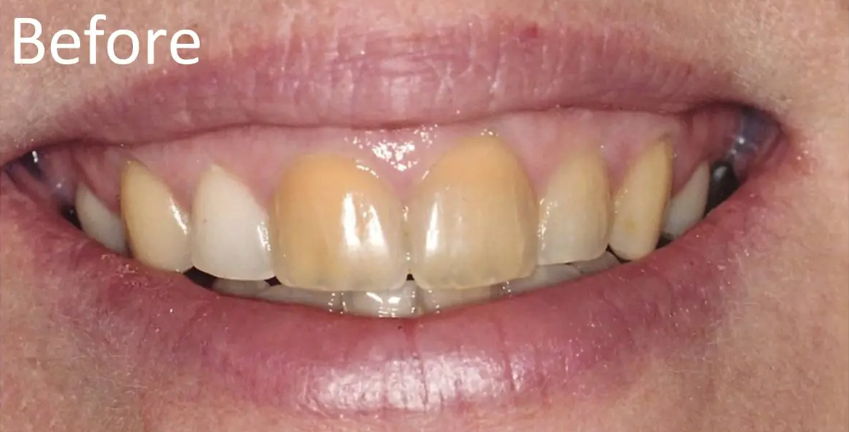 General and Cosmetic Dentistry of Tampa - Randall Diez and Michael Diez