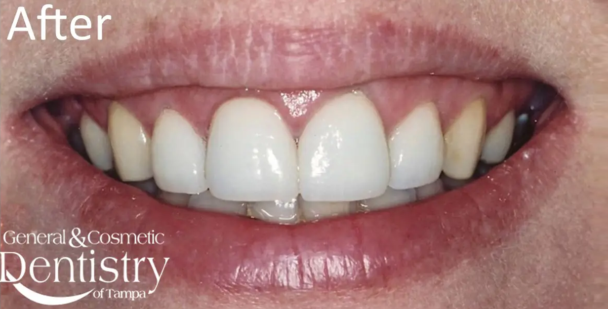 General and Cosmetic Dentistry of Tampa - Randall Diez and Michael Diez