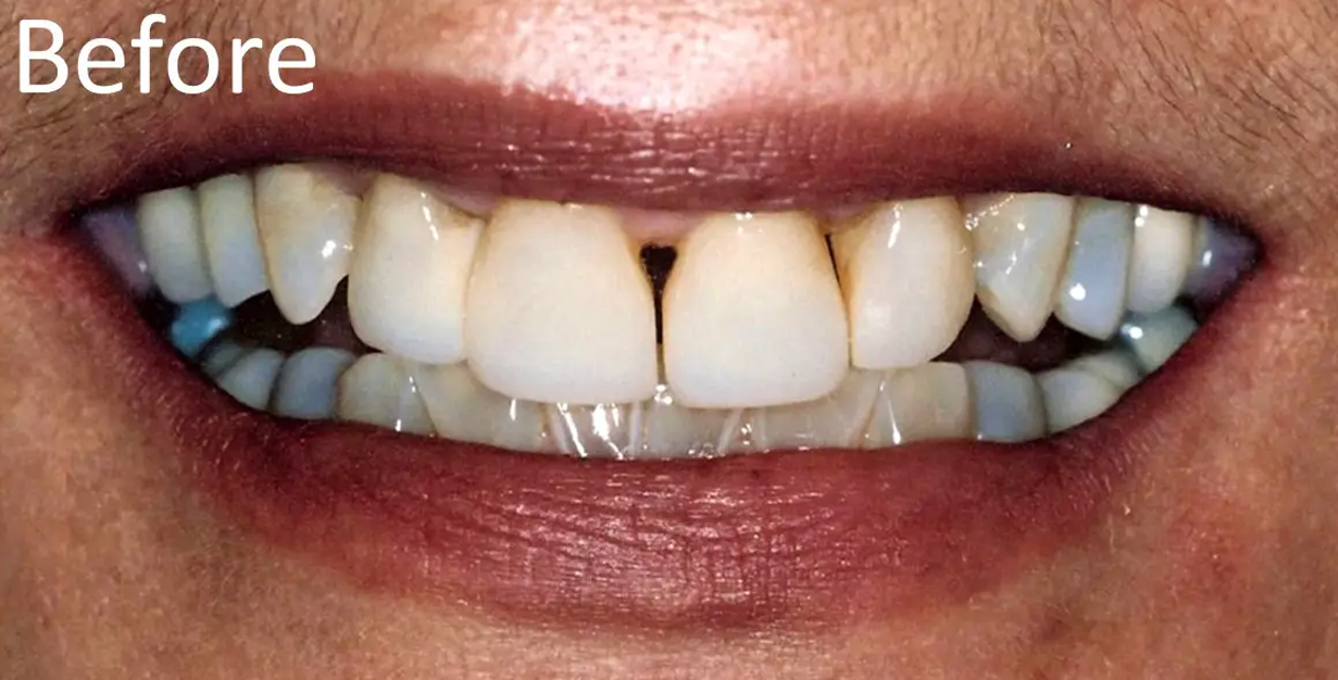 General and Cosmetic Dentistry of Tampa - Randall Diez and Michael Diez