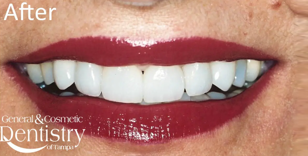 General and Cosmetic Dentistry of Tampa - Randall Diez and Michael Diez