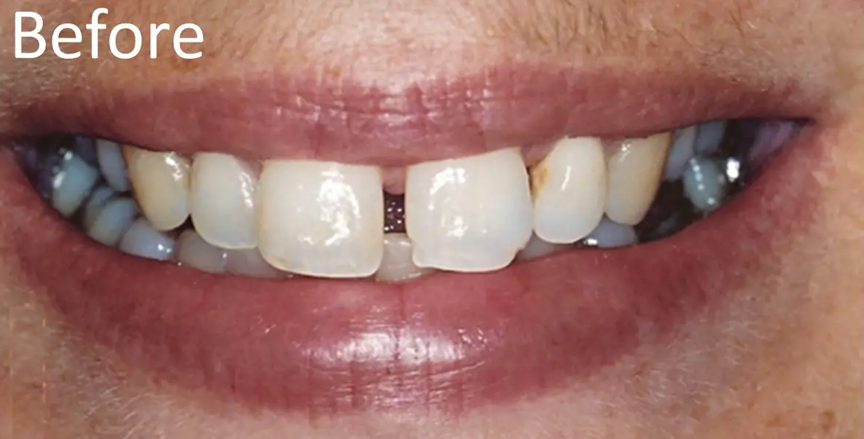 General and Cosmetic Dentistry of Tampa - Randall Diez and Michael Diez