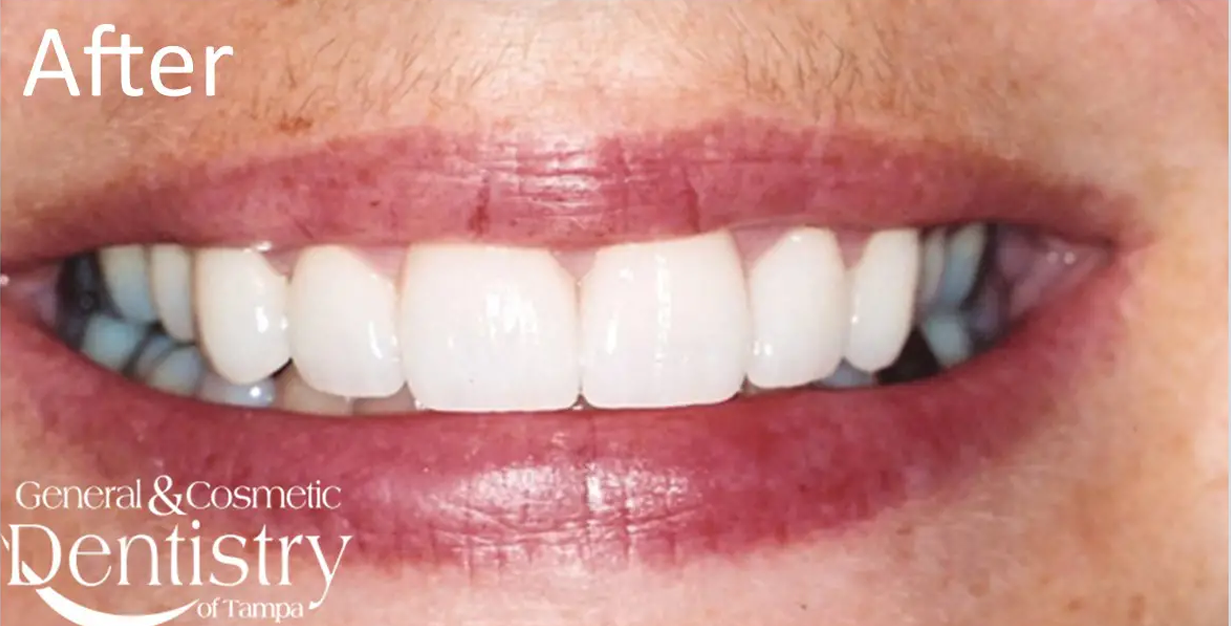 General and Cosmetic Dentistry of Tampa - Randall Diez and Michael Diez