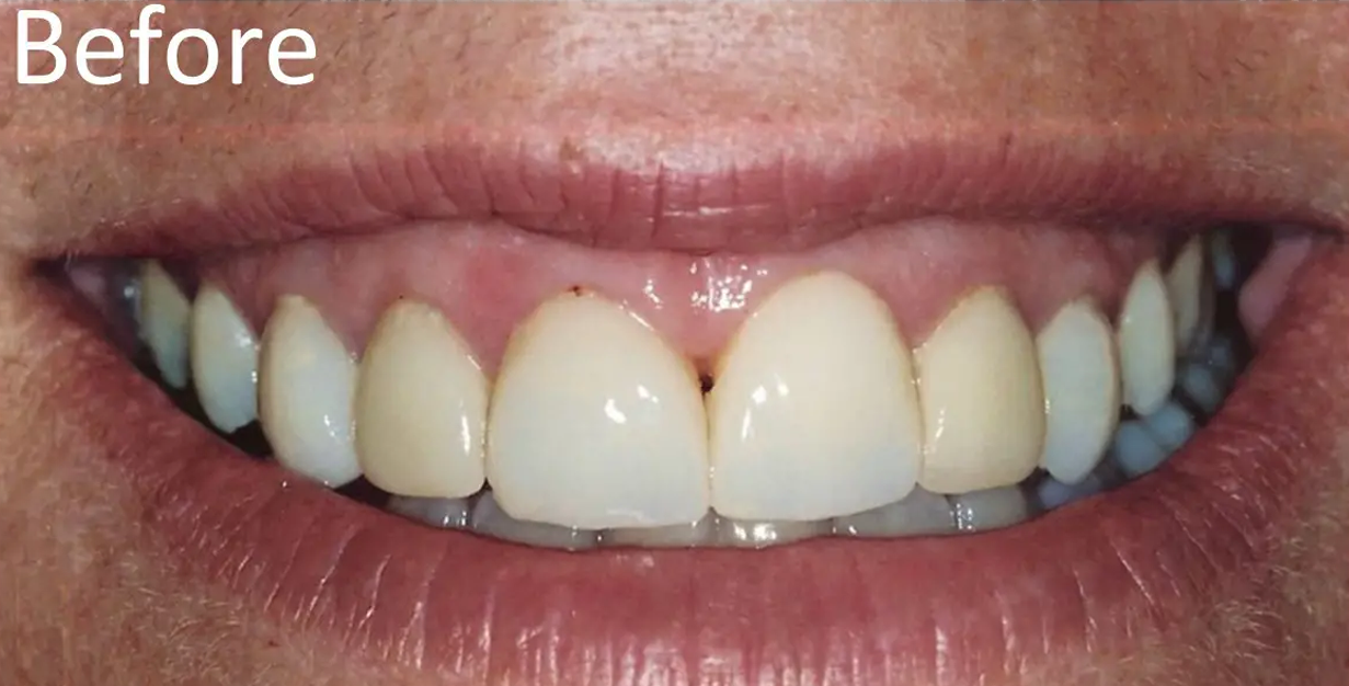 General and Cosmetic Dentistry of Tampa - Randall Diez and Michael Diez