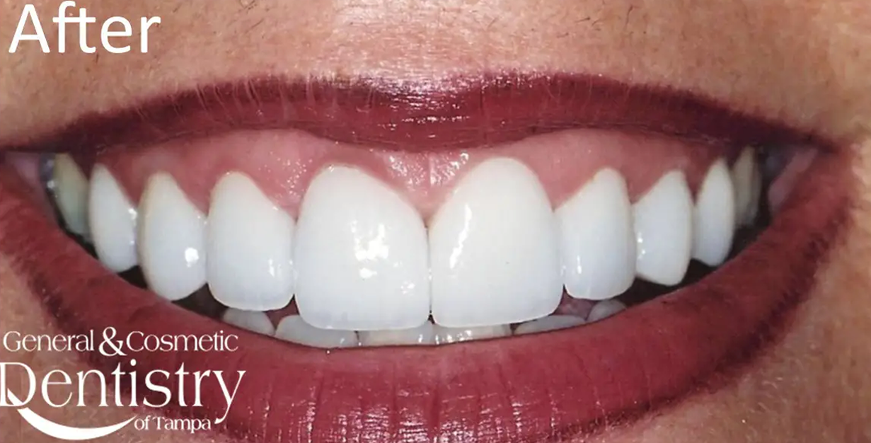 General and Cosmetic Dentistry of Tampa - Randall Diez and Michael Diez