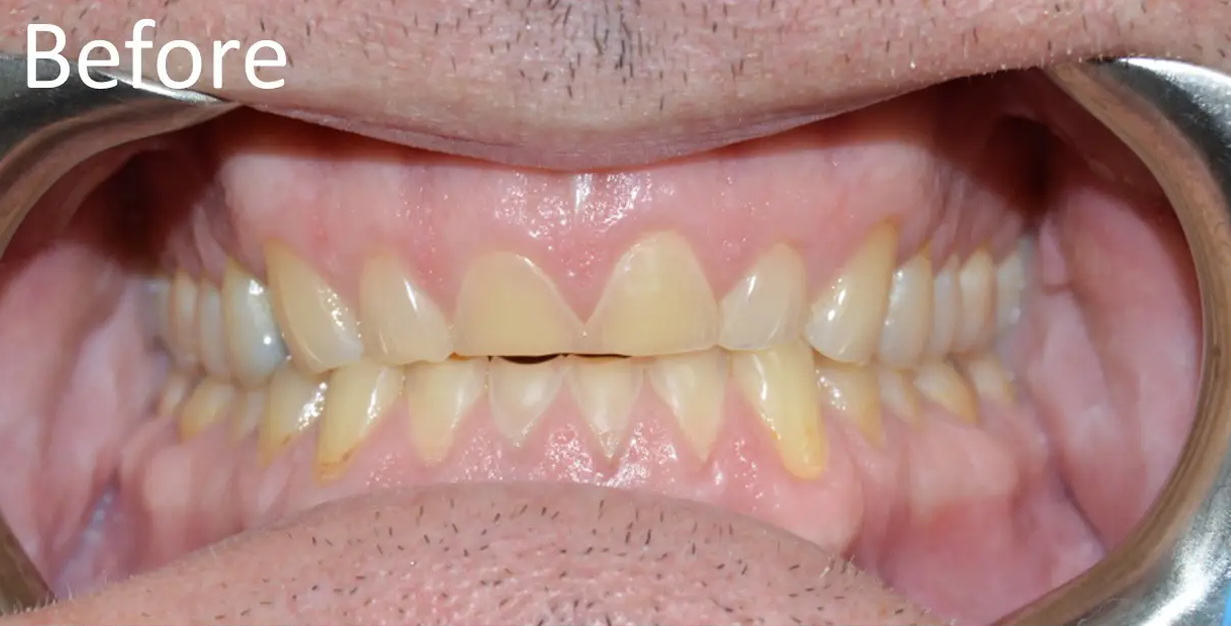 General and Cosmetic Dentistry of Tampa - Randall Diez and Michael Diez