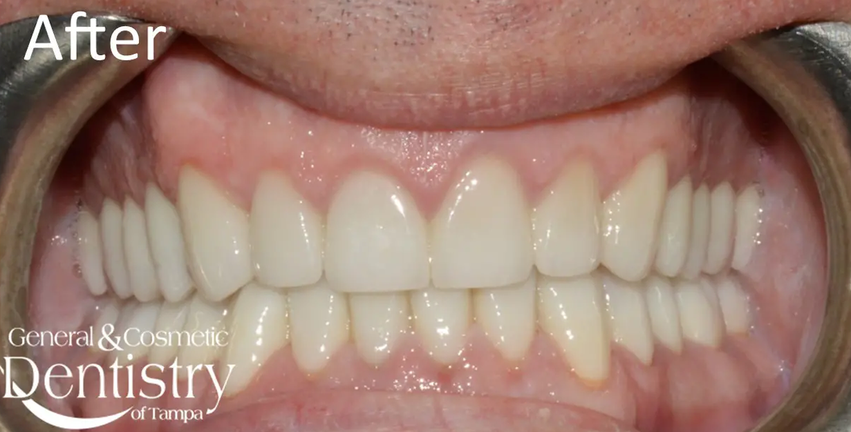 General and Cosmetic Dentistry of Tampa - Randall Diez and Michael Diez