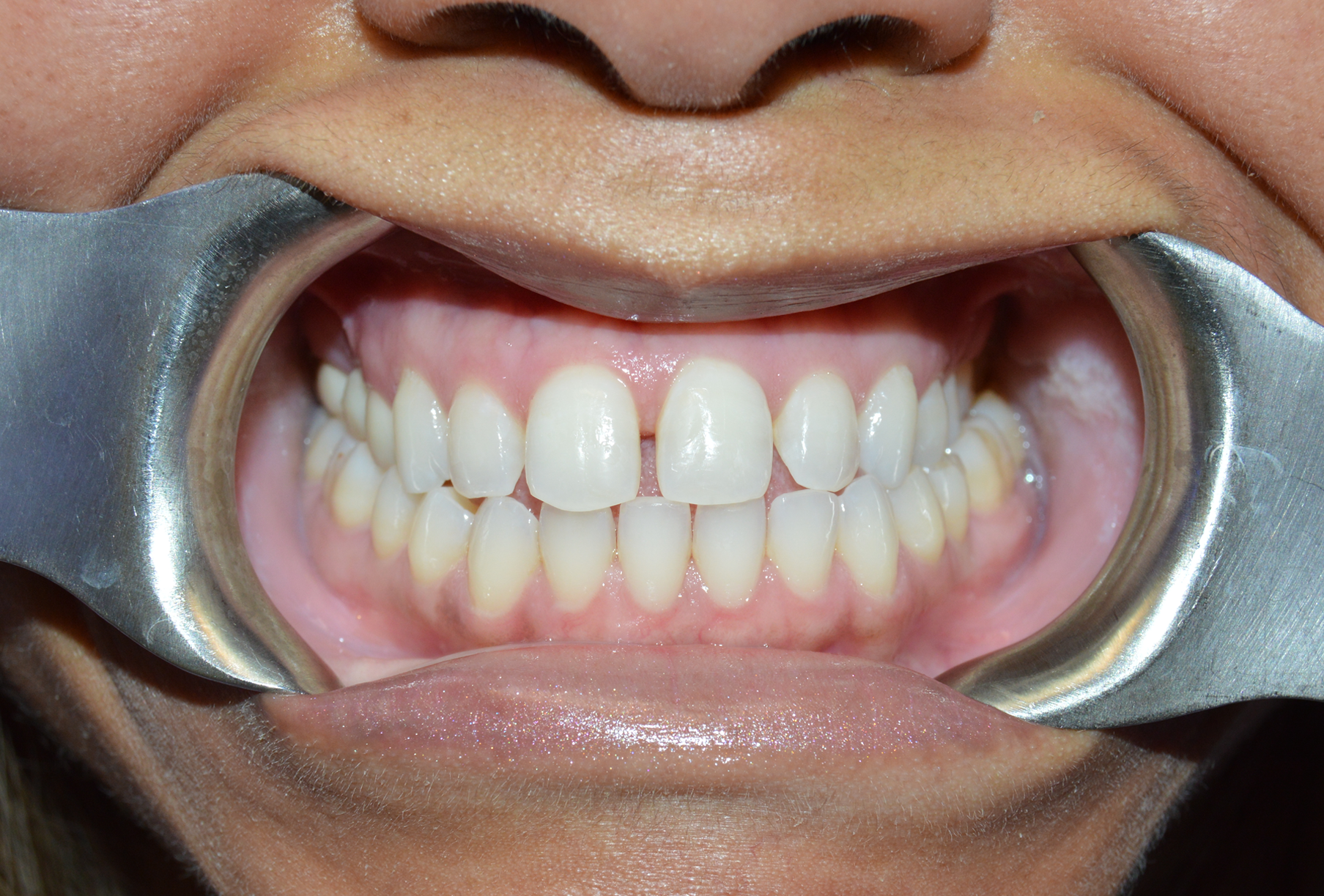 General and Cosmetic Dentistry of Tampa - Randall Diez and Michael Diez