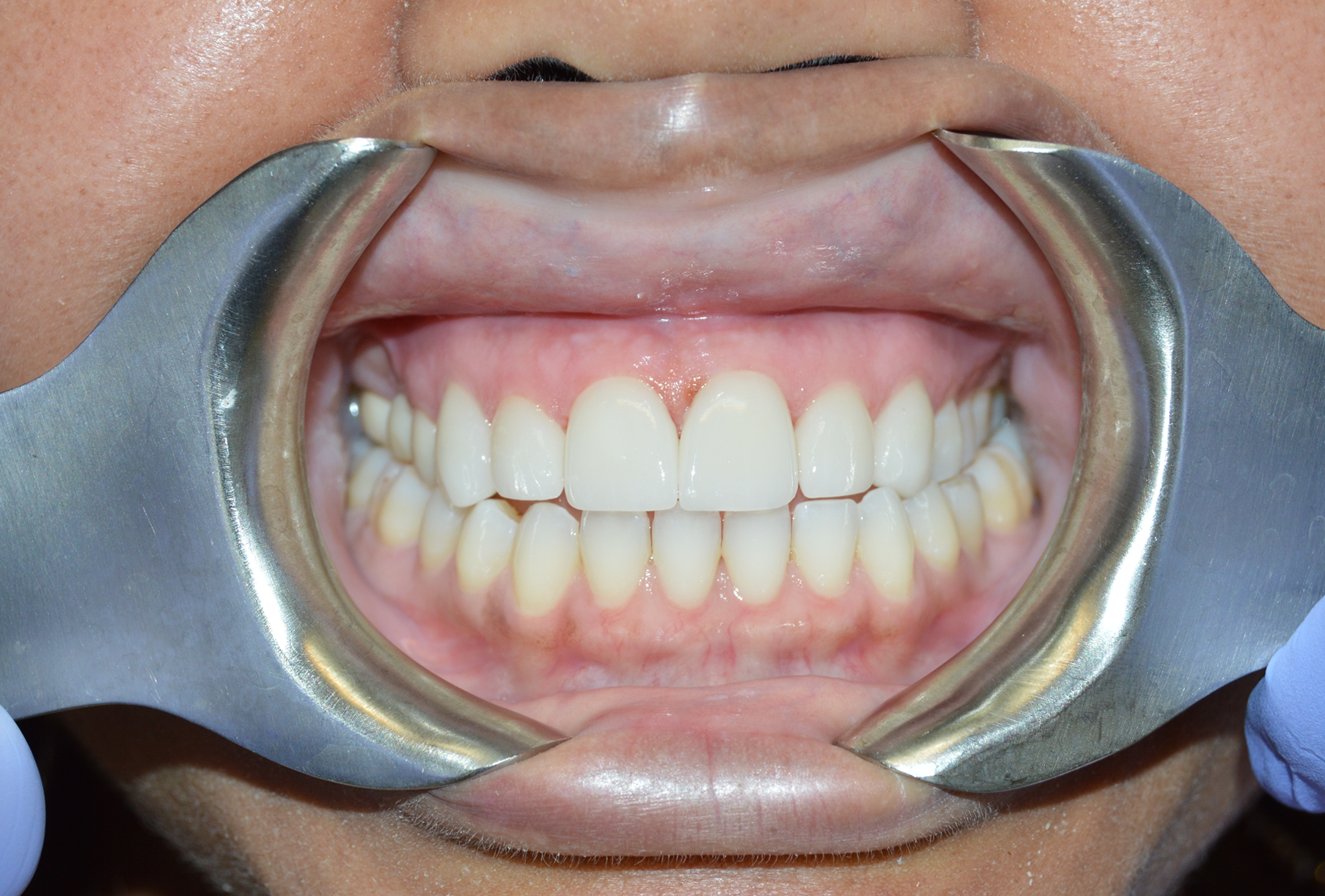 General and Cosmetic Dentistry of Tampa - Randall Diez and Michael Diez