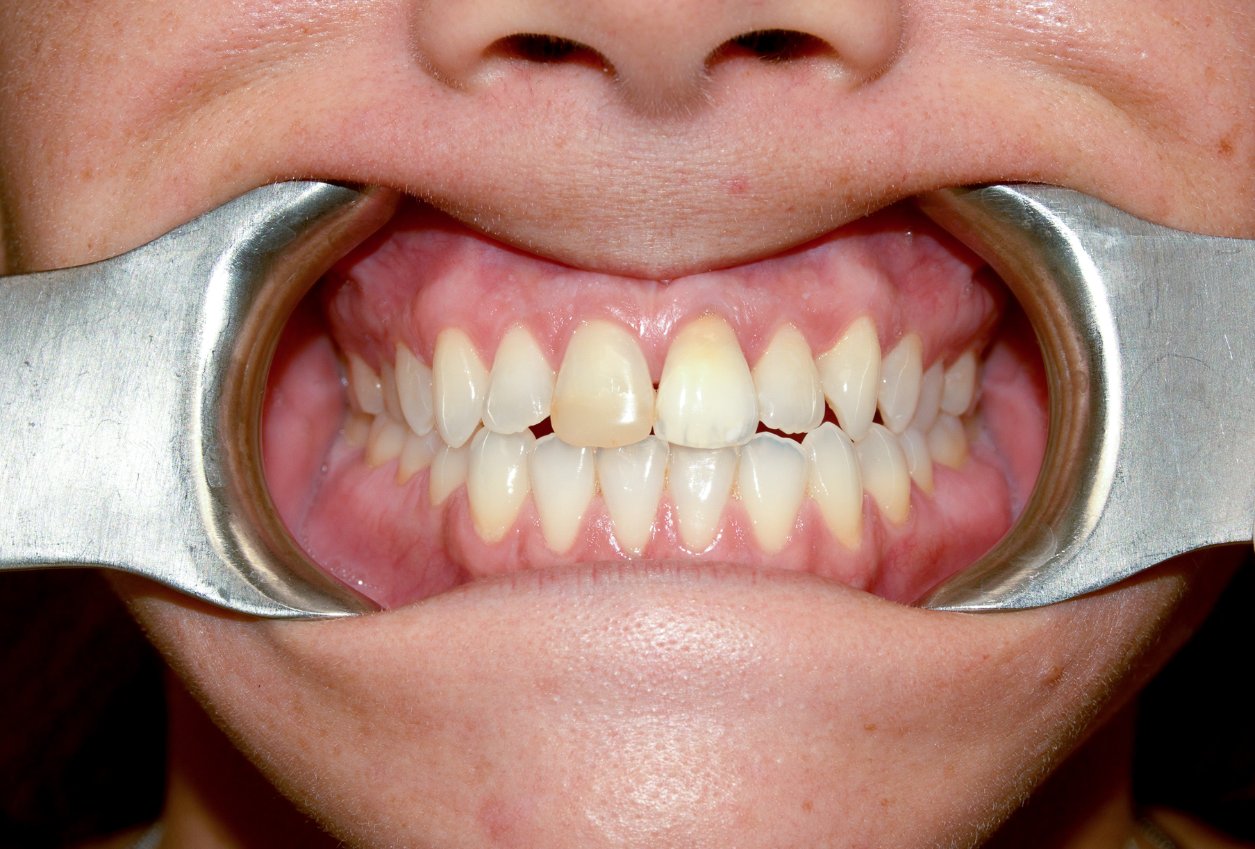 General and Cosmetic Dentistry of Tampa - Randall Diez and Michael Diez