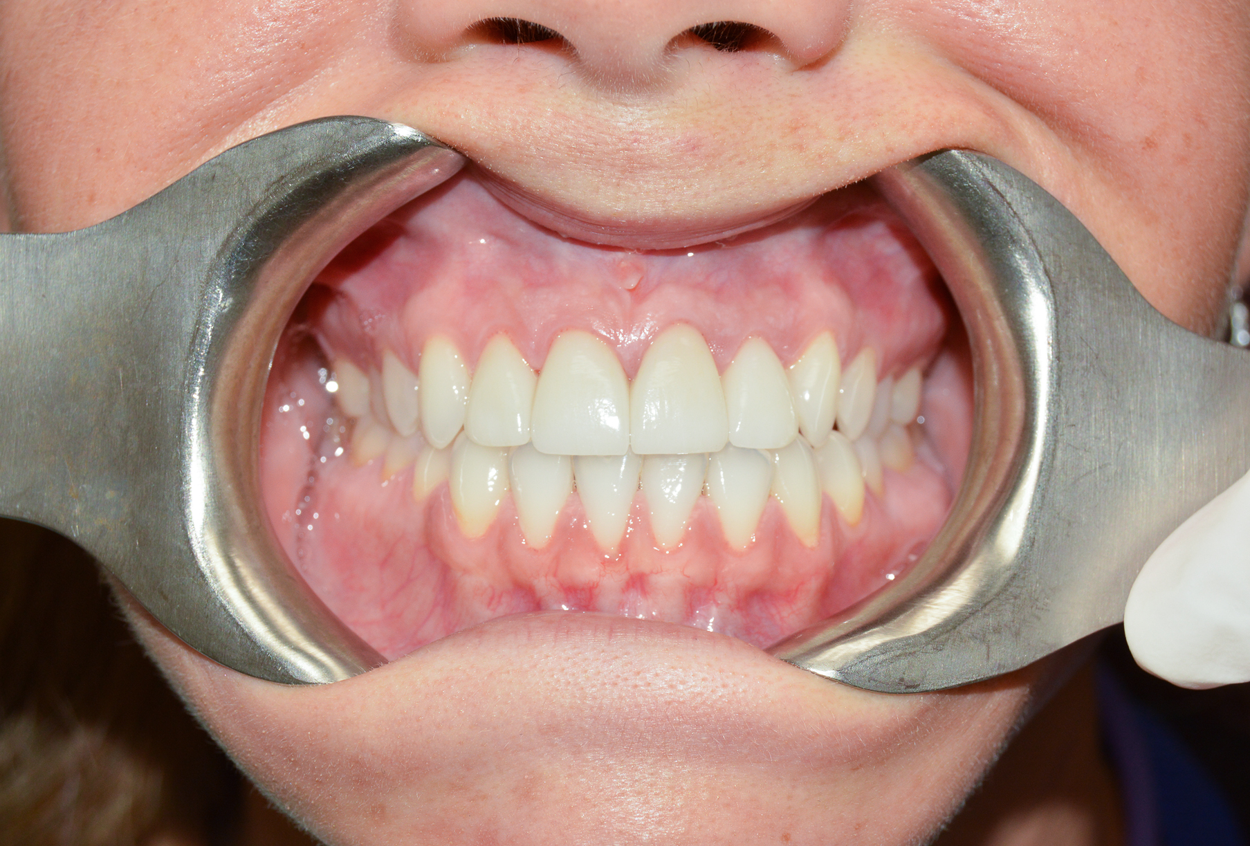 General and Cosmetic Dentistry of Tampa - Randall Diez and Michael Diez