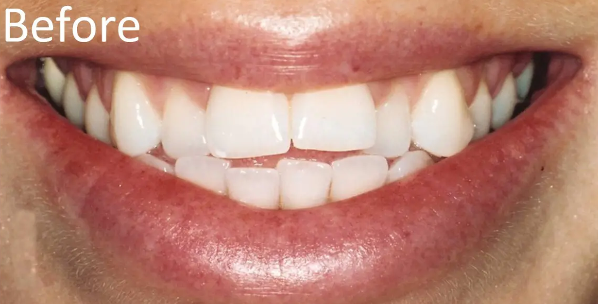 General and Cosmetic Dentistry of Tampa - Randall Diez and Michael Diez