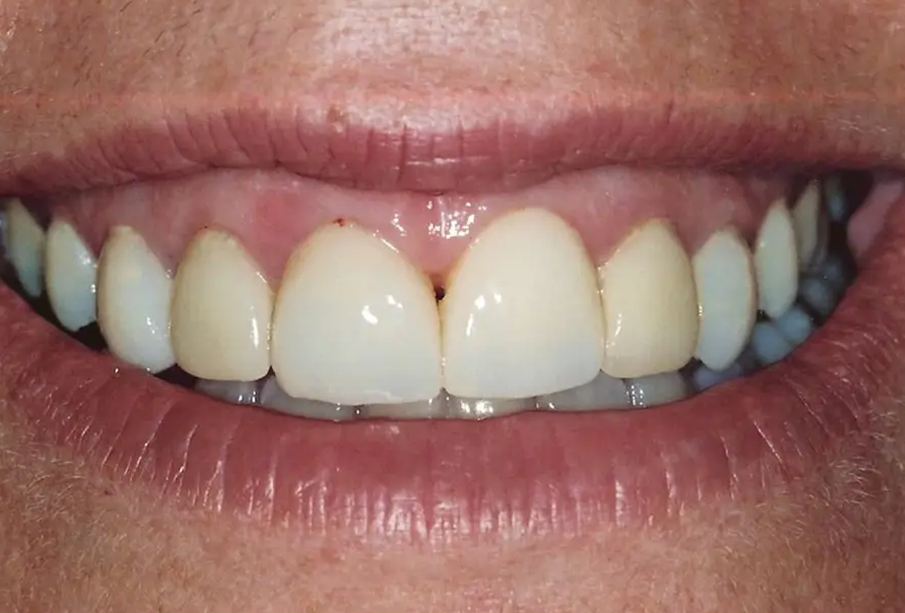 General and Cosmetic Dentistry of Tampa - Randall Diez and Michael Diez