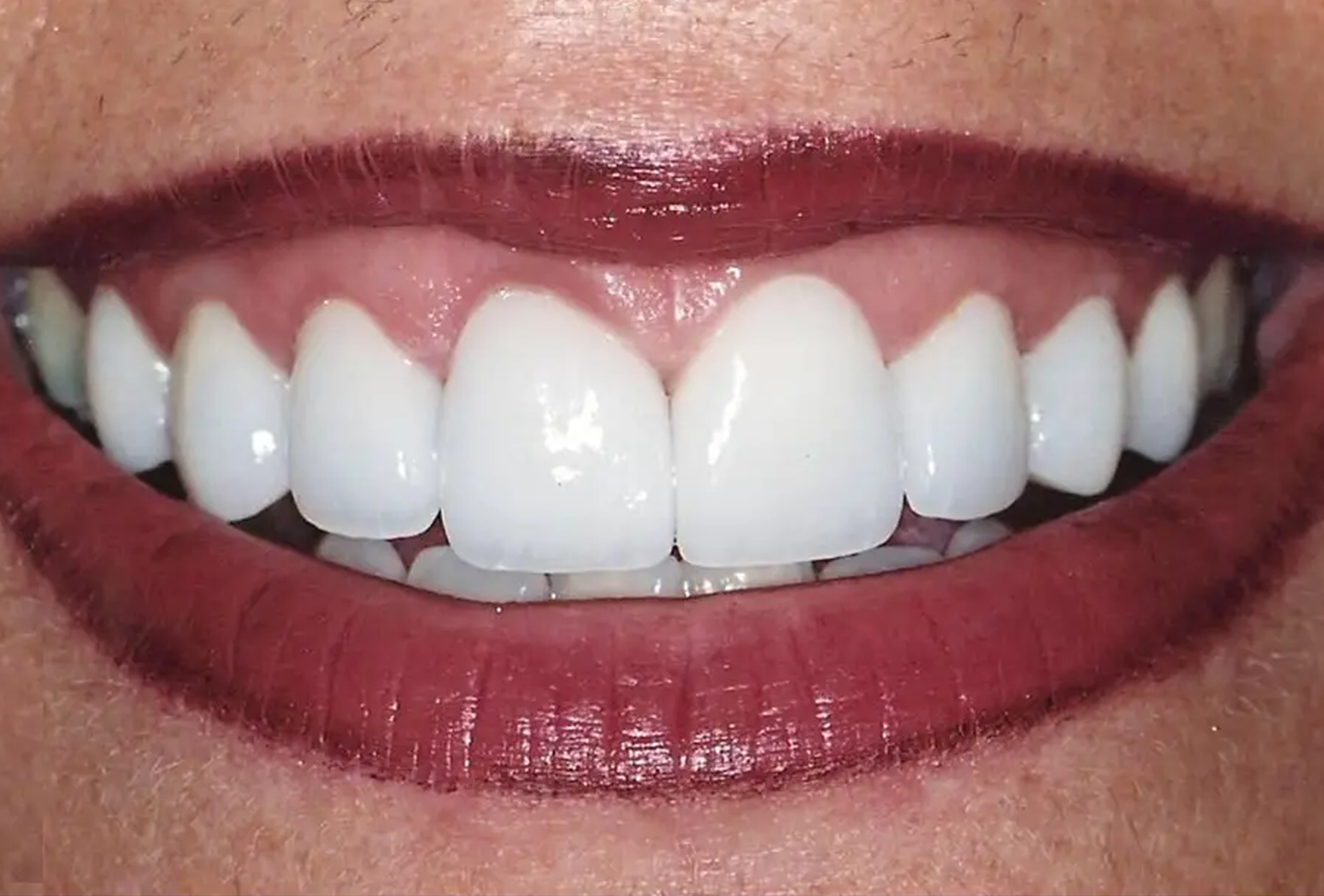 General and Cosmetic Dentistry of Tampa - Randall Diez and Michael Diez