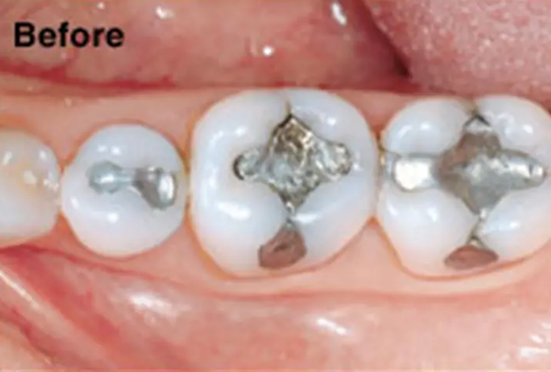 General and Cosmetic Dentistry of Tampa - Randall Diez and Michael Diez