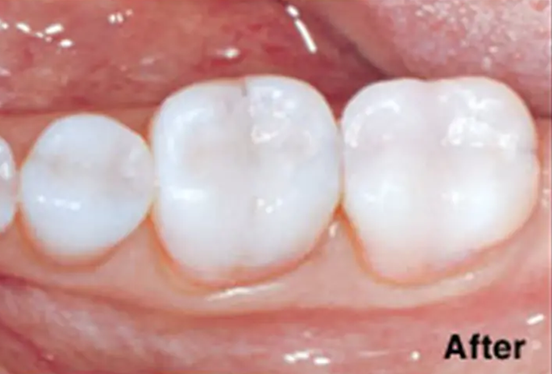 General and Cosmetic Dentistry of Tampa - Randall Diez and Michael Diez