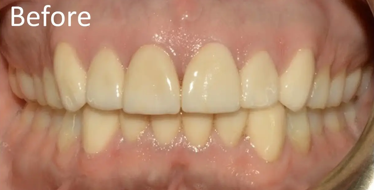 General and Cosmetic Dentistry of Tampa - Randall Diez and Michael Diez