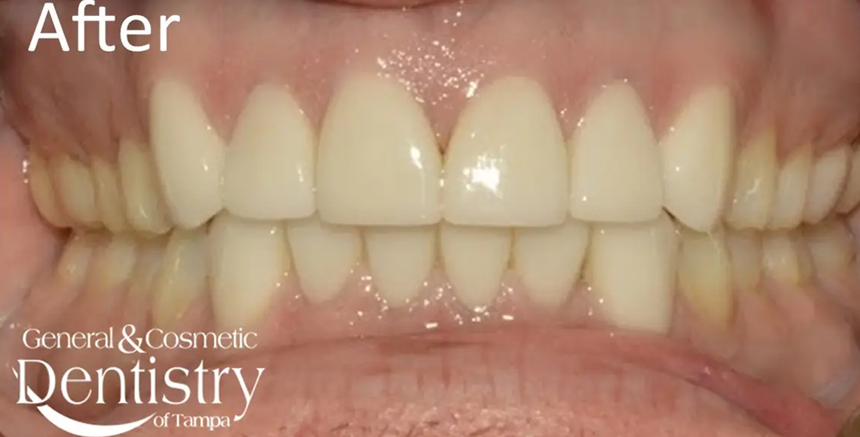 General and Cosmetic Dentistry of Tampa - Randall Diez and Michael Diez