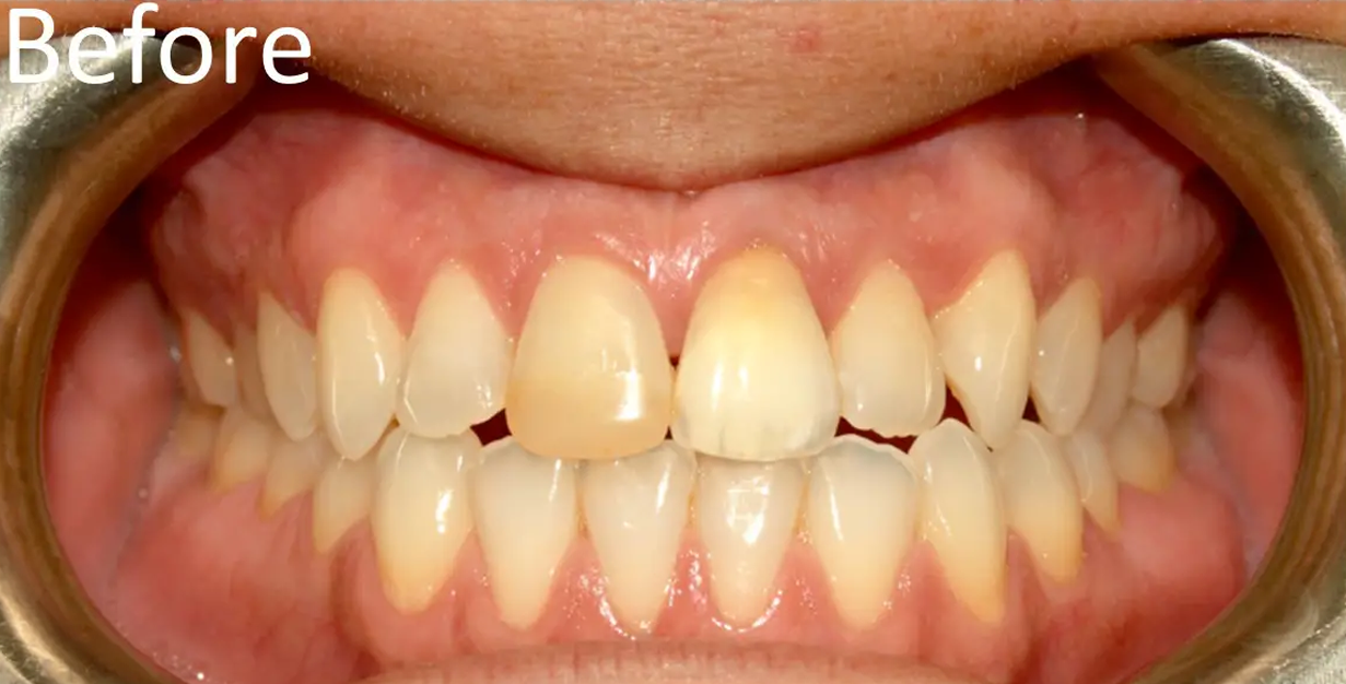 General and Cosmetic Dentistry of Tampa - Randall Diez and Michael Diez