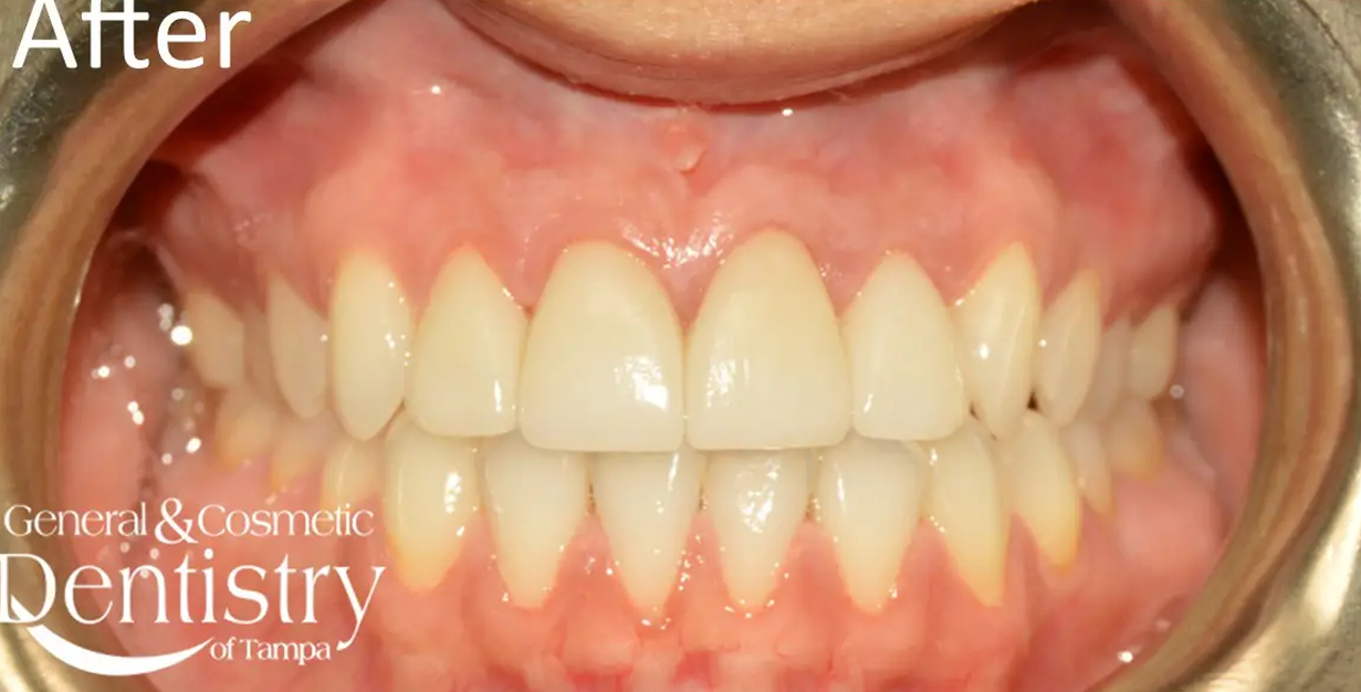 General and Cosmetic Dentistry of Tampa - Randall Diez and Michael Diez