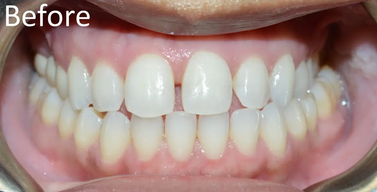 General and Cosmetic Dentistry of Tampa - Randall Diez and Michael Diez