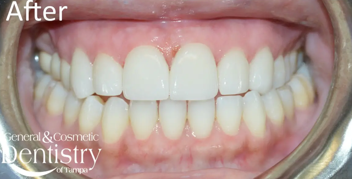 General and Cosmetic Dentistry of Tampa - Randall Diez and Michael Diez