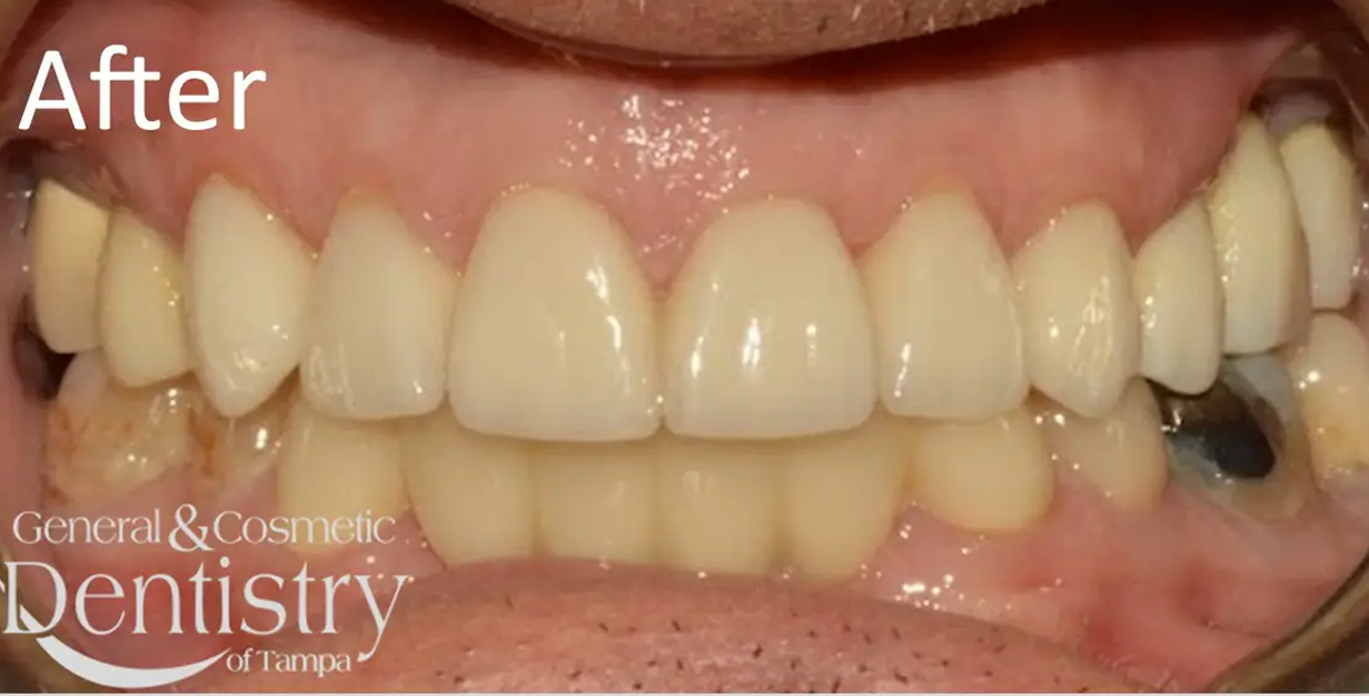 General and Cosmetic Dentistry of Tampa - Randall Diez and Michael Diez