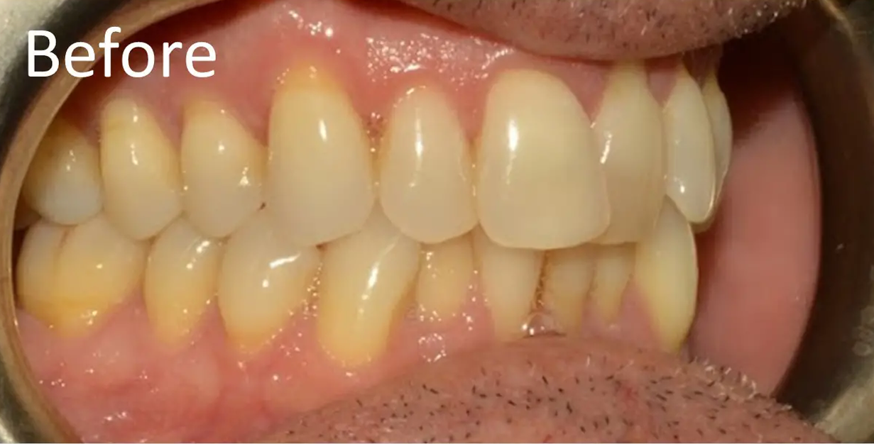 General and Cosmetic Dentistry of Tampa - Randall Diez and Michael Diez