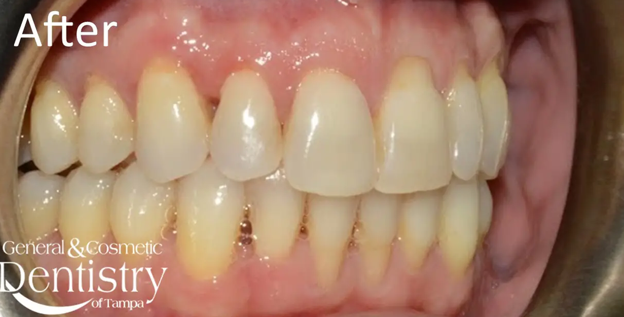 General and Cosmetic Dentistry of Tampa - Randall Diez and Michael Diez