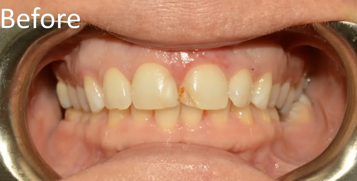 General and Cosmetic Dentistry of Tampa - Randall Diez and Michael Diez