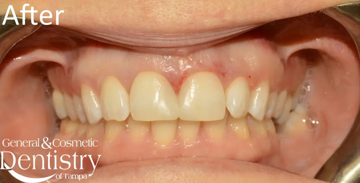 General and Cosmetic Dentistry of Tampa - Randall Diez and Michael Diez