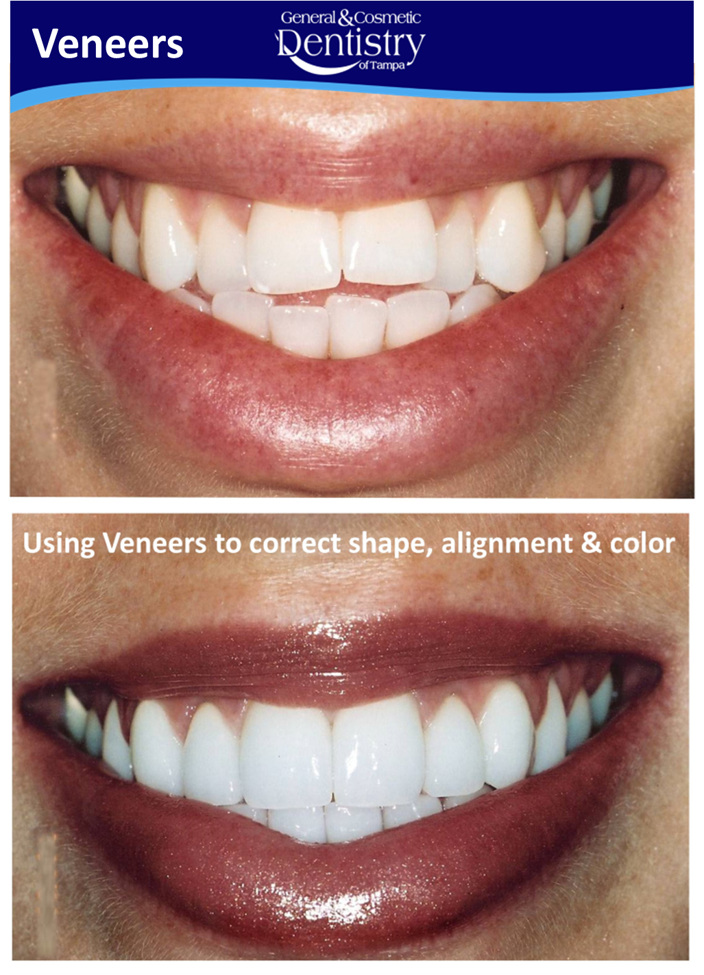 General and Cosmetic Dentistry of Tampa - Randall Diez and Michael Diez